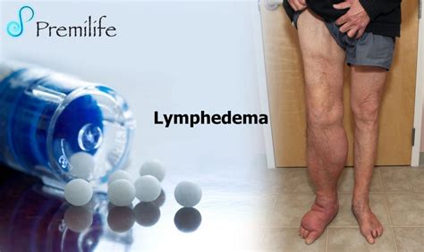Lymphedema Premilife Homeopathic Remedies