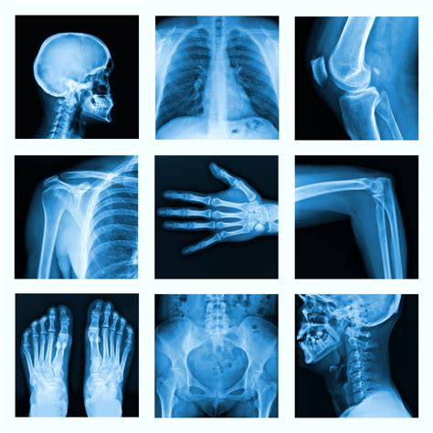All Part Of Human Bone X Ray A New Approach To Bone Injuries Day 101