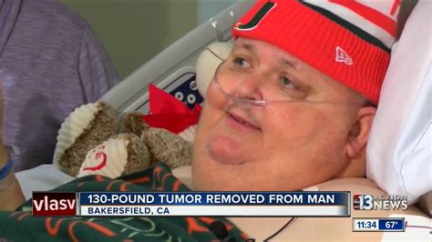 130 Pound Tumor Removed From Man Youtube