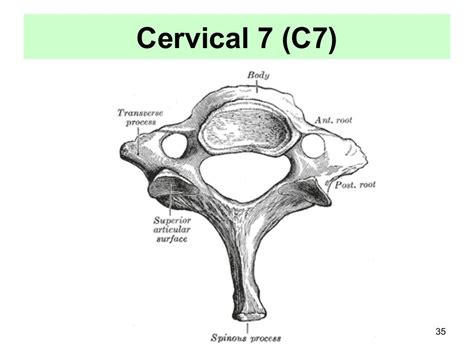 35 Cervical Vertebra