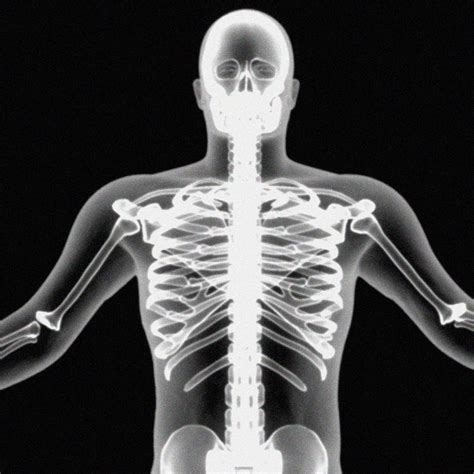 X Ray Skeleton Xray Body Human Obj