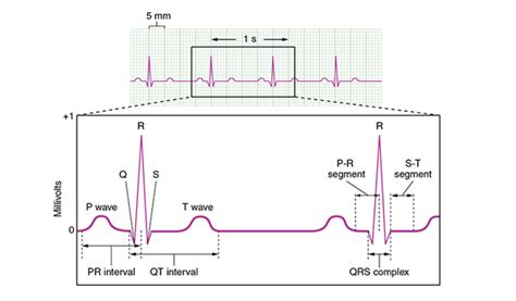 Elecrocardiogram Ecg Procedure Ecg Test At Byjus