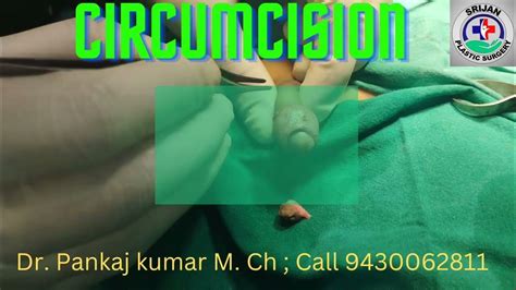 Circumcision Surgery In Ranchi Circumcision In Ranchi By Dr Pankaj Kumar Mch Circumcision