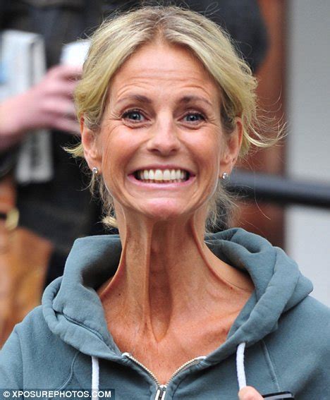 Ulrika Jonsson Fails To Hide Her Shockingly Frail And Gaunt Body