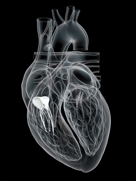 Human Heart Tricuspid Valve Photograph By Sebastian Kaulitzkiscience