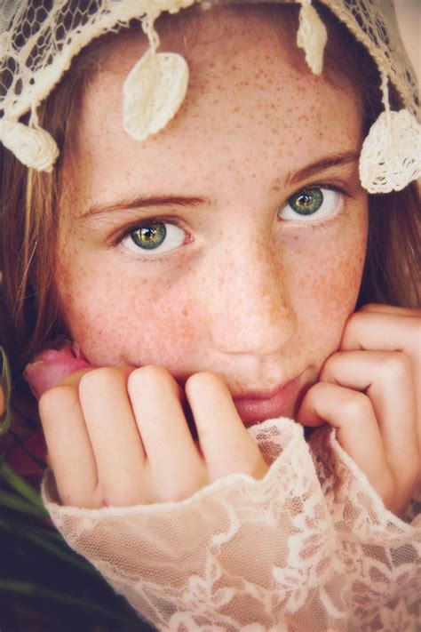 Freckles Photo Contest Winners VIEWBUG Com