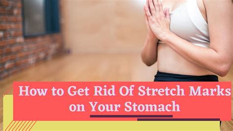 How To Get Rid Of Stretch Marks On Your Stomach Dgs Health