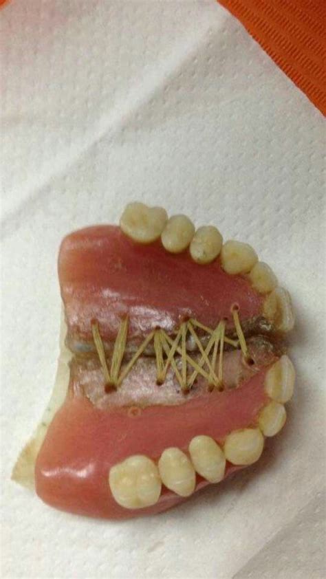 166 Best Images About Dental Technician Meme On Pinterest
