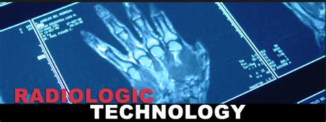 Congratulations July 2014 Radiologic Technologist Radtech Board Exam