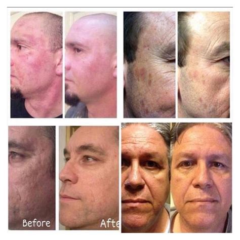 40 % of Nerium customers are men, and 40% of our distributor Brand
