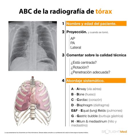 ABC de la Radiografía de Tórax Fuente SpotlightMed Facebook