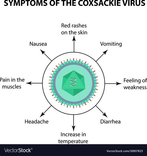 Symptoms Of Infection Coxsackie Virus Royalty Free Vector