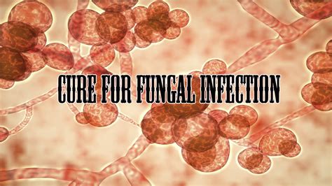 Fungal Infection Youtube