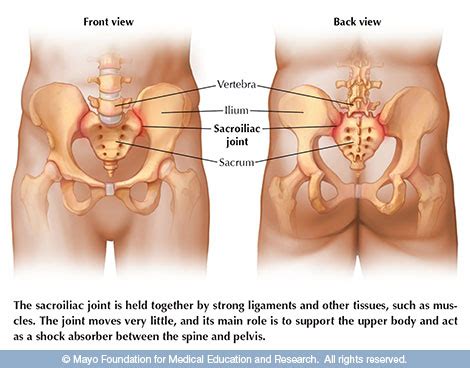 Lower back tightness is a common complaint among many people. Sacroiliac joint dysfunction