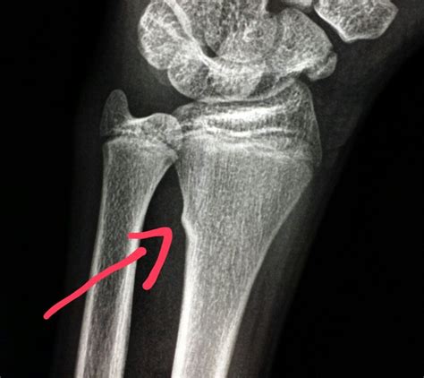 Pin Op Unusual X Rays