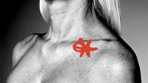 Swollen Supraclavicular Lymph Nodes What Does It Mean