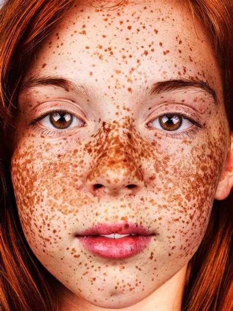These Portraits Celebrate The Joy Of Having Freckles Artofit