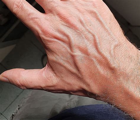 Hands Veiny Bulging Nerves Pop Out