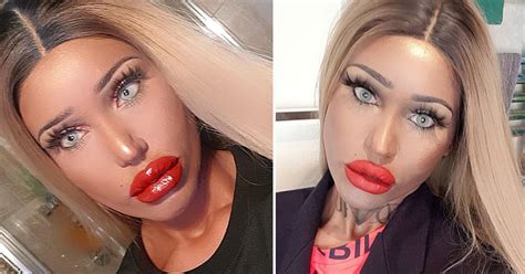 Woman who spent $100,000 to look like blowup doll is facing complications from cosmetic surgeries. Mother - Who Looks Like A Blow-Up Doll - Says Her Children ...