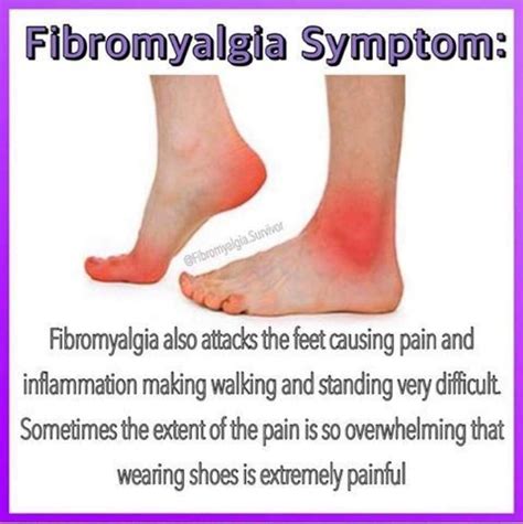 Pin On Fibromyalgiachronic Pain