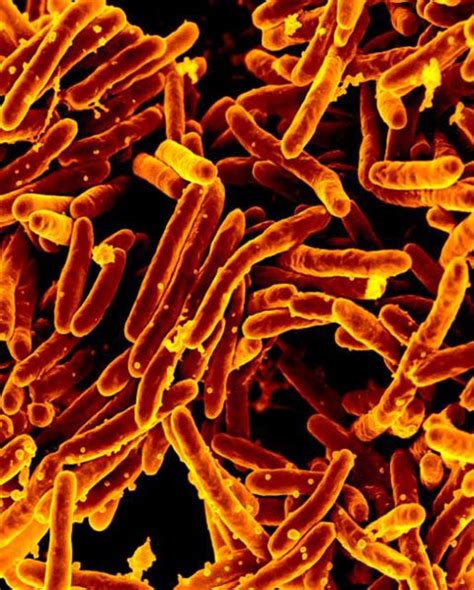 Antibiotic Resistant Superbugs Are Causing Bacterial Infections