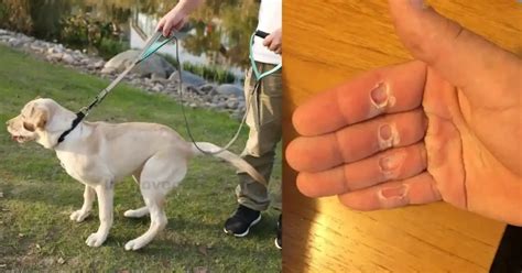 What To Put On Rope Burn From Dog Leash Last Love Pets