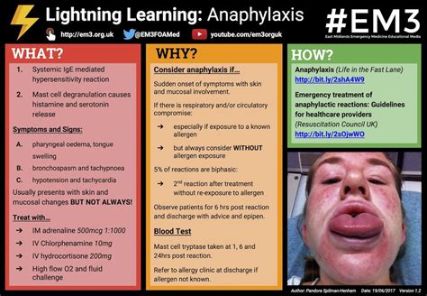 Anaphylaxis is a serious allergic reaction that is rapid in onset and may cause death. Lightning Learning: Anaphylaxis — #EM3: East Midlands ...