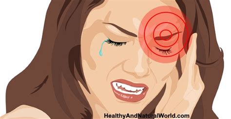 Headache Above Or Behind The Left Eye Causes And Treatments