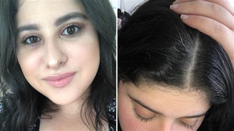 My Hair Started Going Gray At 20 Years Old — Heres How I Embraced It Allure