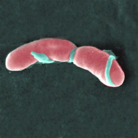10 Facts About Listeria Less Known Facts