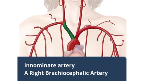 Innominate Artery A Right Brachiocephalic Artery Daily Medicos