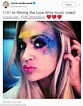 Carrie Underwood shows off facial scar in throwback photo almost a year ...