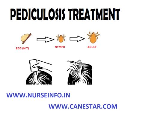 Pediculosis Treatment Nurse Info