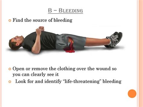 External Bleeding Of Extremities And Emergency Care Online Presentation