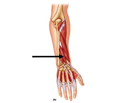 Early active mobilization of primary repairs of the flexor pollicis longus tendon with two kessler two. FUNCTIONAL FINAL - Kinesiology 3100 with Distefano at University of Connecticut - StudyBlue