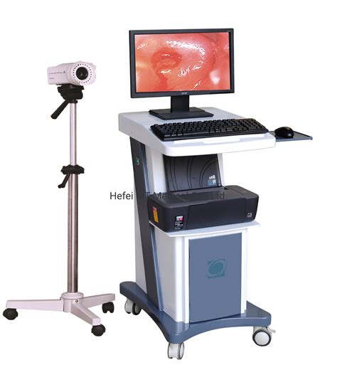 Mt Medical China Manufacturer Digital Colposcope For Gynecology Vagina Video Colposcopy China