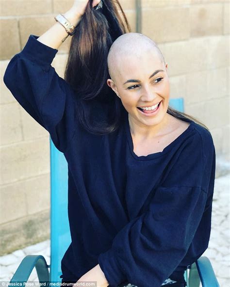 Woman With Alopecia Finally Embraces Her Natural Look Daily Mail Online