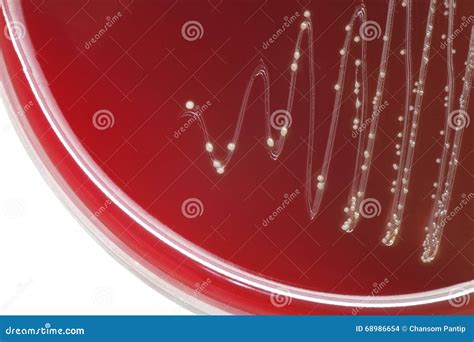 Streptococcus Bacterial Colonies With Alpha Hemolytic On Blood A