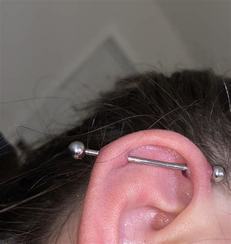 Just Noticed This Dark Colored Bump On My Industrial Piercing Today Pierced 10312021 How