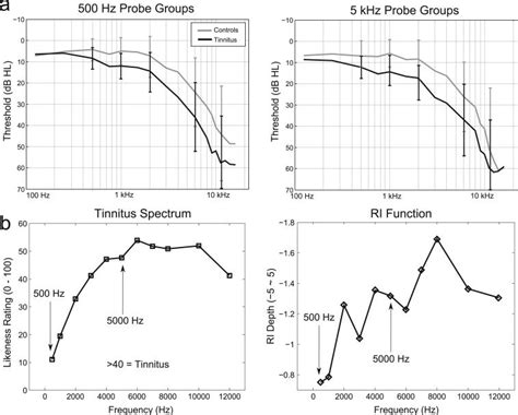 A Audiometric Thresholds Left And Right Ears Averaged For Control