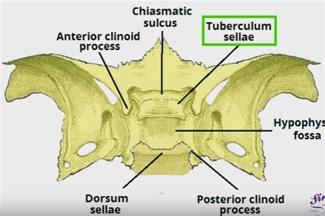 Sella Turcica Bone Function Site Location Anatomy Empty Sella