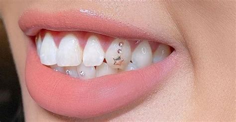 Pin By Z L N On It S All About The Bling Jewelry In Tooth