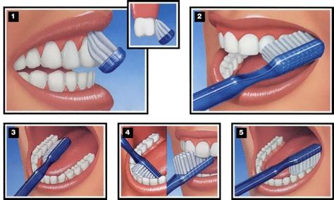 Tips Para Un Buen Cepillado Dental Soluci N Dental