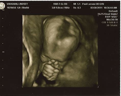 Blessed By Brody 20 Week Ultrasound Pics