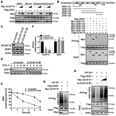 tumor suppressor dcaf15 inhibits epithelial mesenchymal transition by targeting zeb1 for