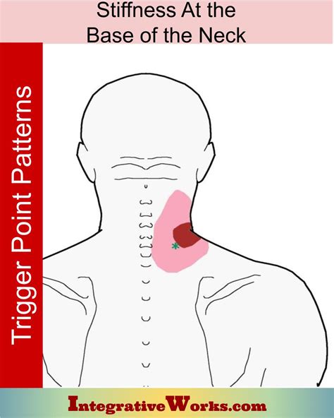 Pain At The Base Of The Neck When Turning Integrative Works