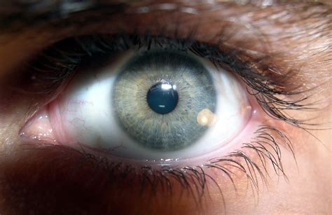 Filebrown Human Eye 2 Wikimedia Commons