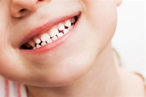 Teeth Grinding And Kids 6 Reasons Why Your Child May Grind His Teeth