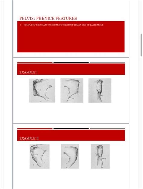 pelvis general features complete the chart to