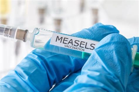 Measles Outbreak Another 90 Cases Reported For Biggest Jump This Year